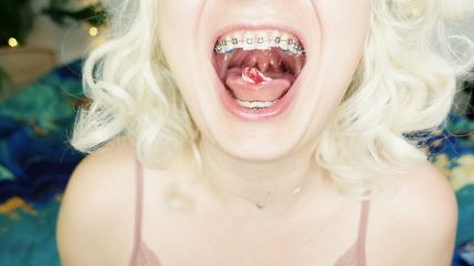 Braces Fetish: Asmr Video Of Eating Mukbang… free video